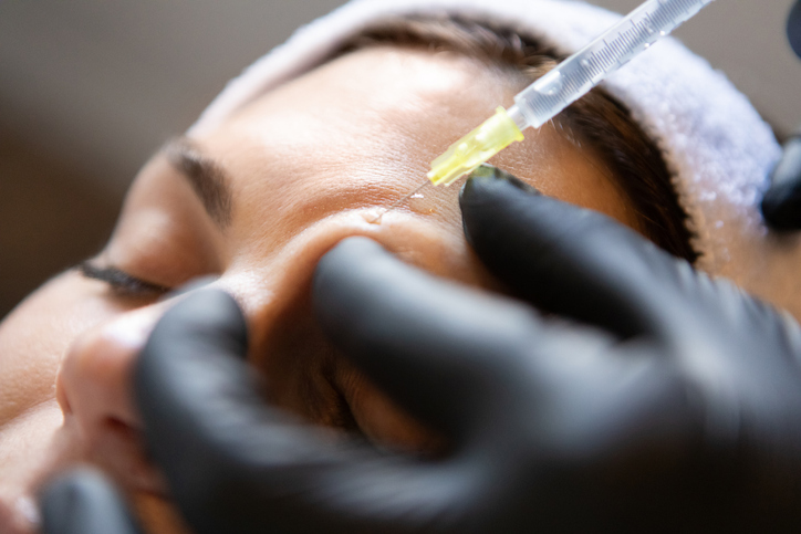 Close-up of a woman receiving a cosmetic forehead injection (Botox) from a gloved practitioner
