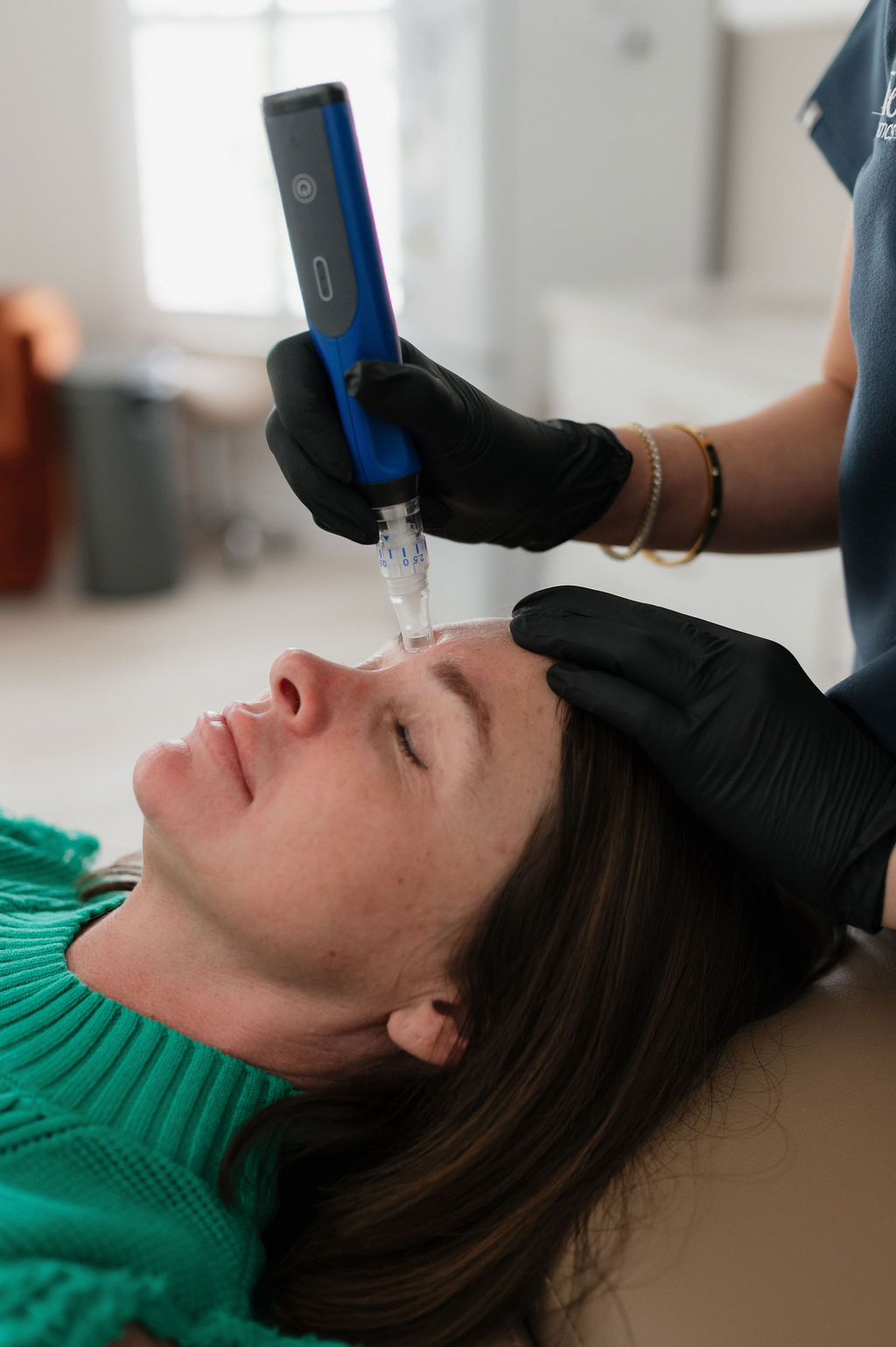 Woman reclined receiving microneedling facial treatment on forehead from clinician using handheld device, black gloves