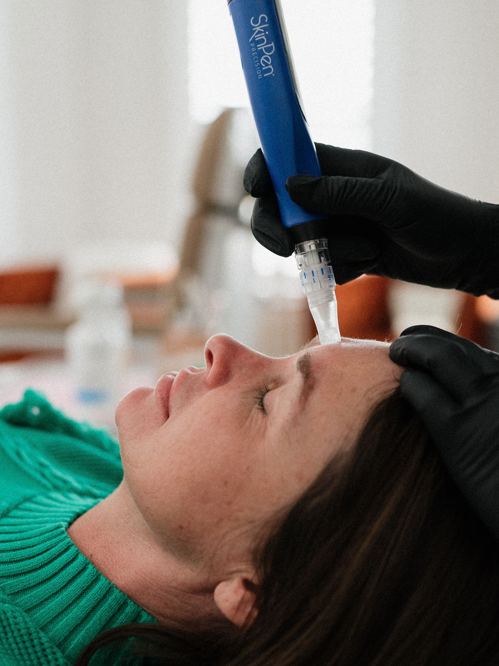 Woman receiving microneedling with SkinPen on forehead from technician wearing black gloves