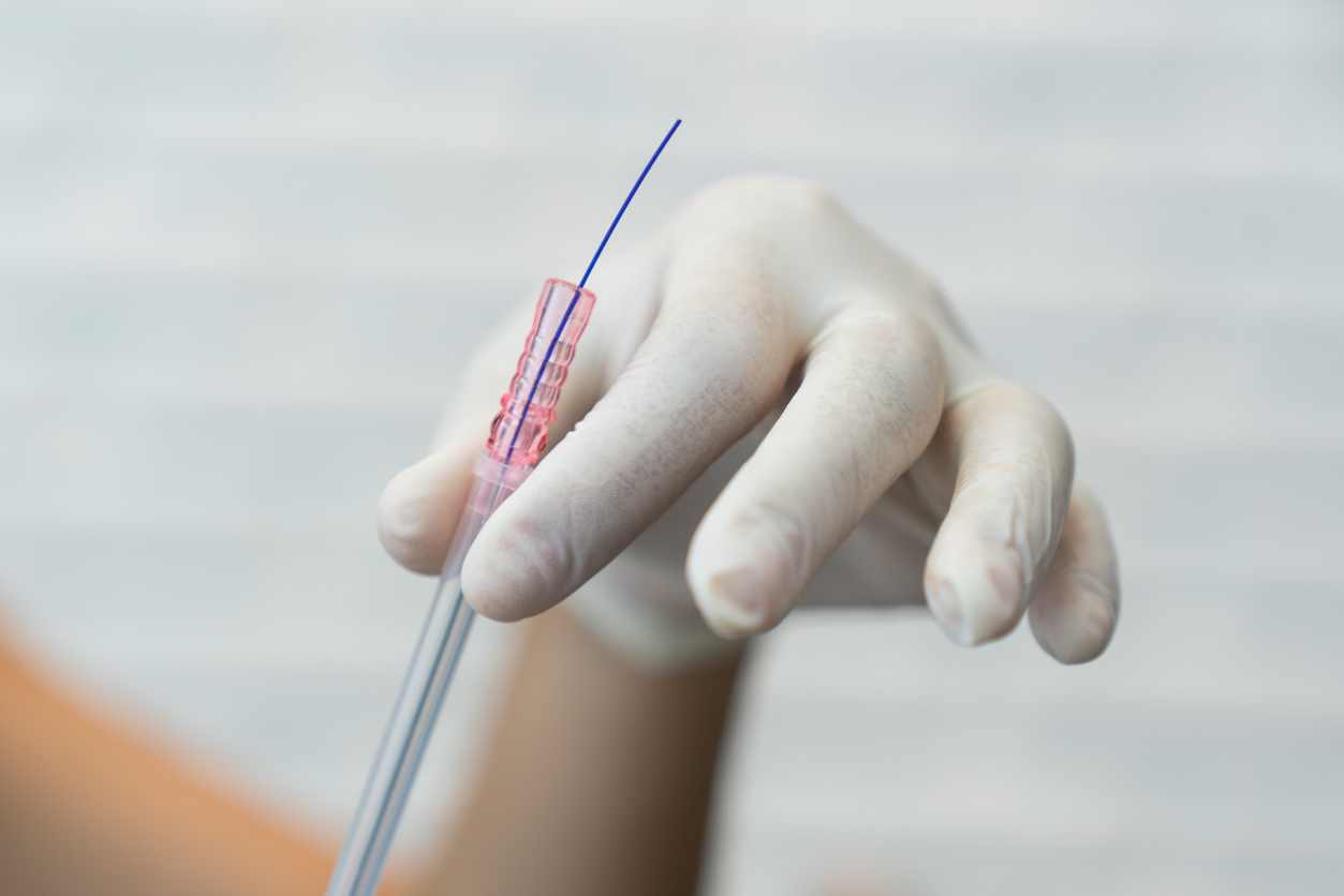 Gloved hand holding a thin blue guidewire threaded through a clear medical catheter tube