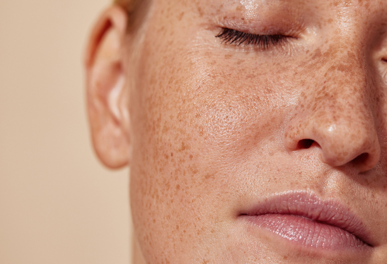 Close-up of a woman's freckled face with closed eyes and natural, glowing skin texture